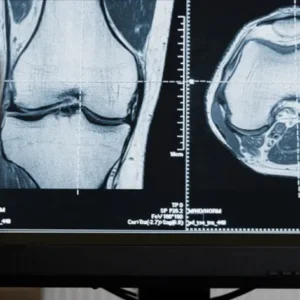 CT – Abdomen And Pelvis